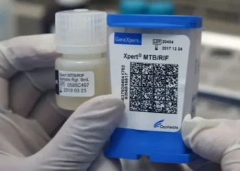 Un innovador test portátil permitirá detectar la tuberculosis en menos de una hora